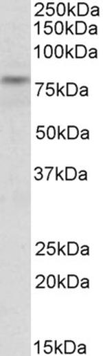 TRIM2 Polyclonal Antibody