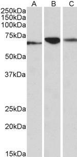 PDIA2 Antibody in Western Blot (WB)