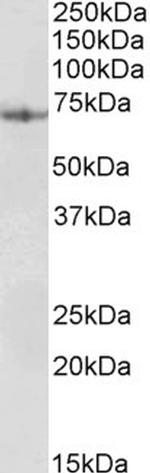 PDIA2 Antibody in Western Blot (WB)