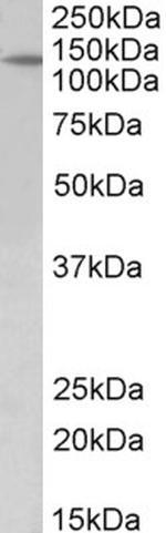 PTCH Antibody in Western Blot (WB)