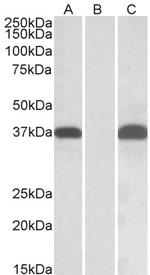 PIM2 Antibody in Western Blot (WB)