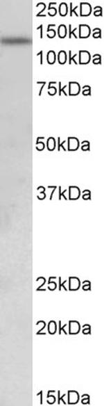 KDM2A Antibody in Western Blot (WB)