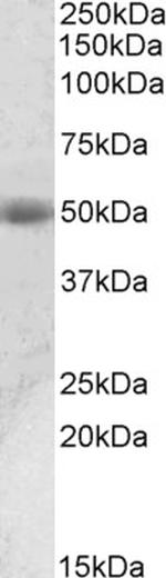 Prostate Specific Acid Phosphatase Polyclonal Antibody, Biotin