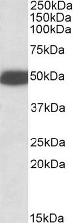 HTR3B Polyclonal Antibody