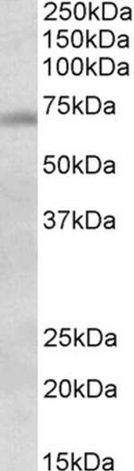 ASK Polyclonal Antibody