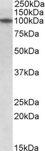 TXNDC11 Antibody in Western Blot (WB)