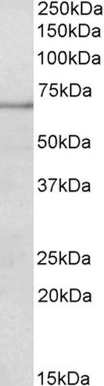 PAPD5 Polyclonal Antibody