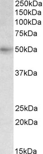 SLC46A1 Polyclonal Antibody