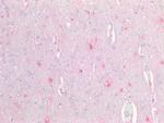 CD56 (NCAM) Antibody in Immunohistochemistry (Paraffin) (IHC (P))