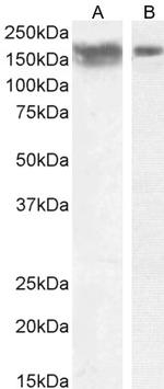 CD56 (NCAM) Antibody in Western Blot (WB)