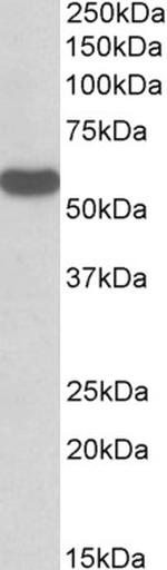 RTCB Antibody in Western Blot (WB)