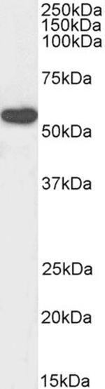 RTCB Polyclonal Antibody, Biotin