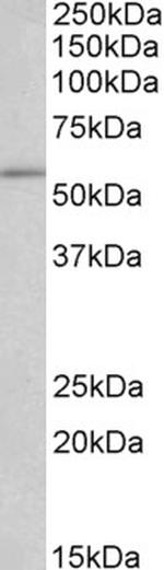 RTCB Antibody in Western Blot (WB)