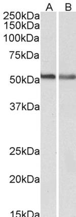 Cannabinoid Receptor 1 Polyclonal Antibody