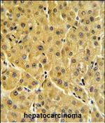 FBP1 Polyclonal Antibody