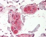 CHRNA5 Antibody in Immunohistochemistry (Paraffin) (IHC (P))