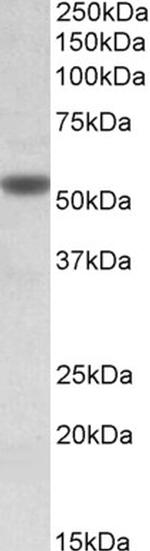 CHRNA5 Antibody in Western Blot (WB)