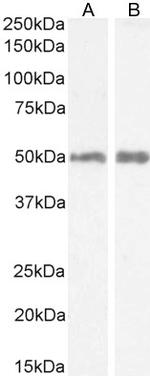 HRH2 Polyclonal Antibody