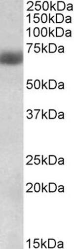 Nrf2 Antibody in Western Blot (WB)