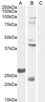 FGF23 Polyclonal Antibody