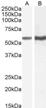 TGFBR1 Antibody in Western Blot (WB)