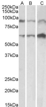 ADAM12 Polyclonal Antibody