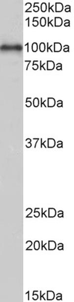ADAM12 Antibody in Western Blot (WB)