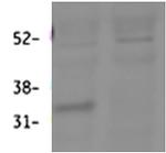 HSD11B1 Polyclonal Antibody
