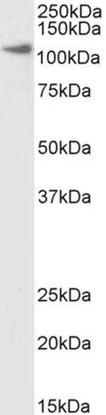 Thyroid Peroxidase Polyclonal Antibody, Biotin
