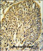 FKBP9 Polyclonal Antibody