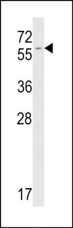FKBP9 Antibody in Western Blot (WB)