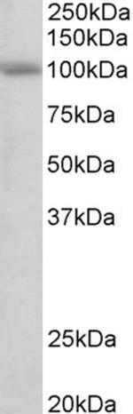 SIDT1 Antibody in Western Blot (WB)