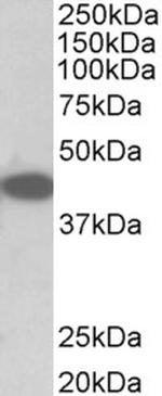 TRIB1 Polyclonal Antibody