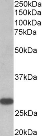 TSH Receptor Polyclonal Antibody
