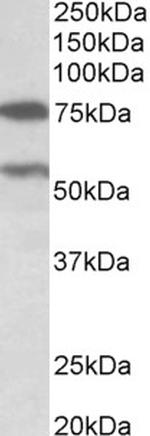PRODH Polyclonal Antibody