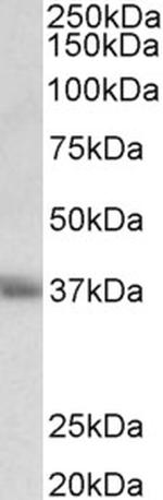CD7 Antibody in Western Blot (WB)