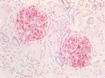 Vimentin Antibody in Immunohistochemistry (Paraffin) (IHC (P))