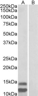 CDKN2B (Isoform 2) Polyclonal Antibody