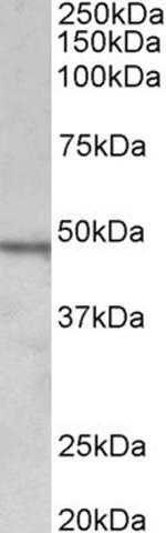 Chitotriosidase Polyclonal Antibody