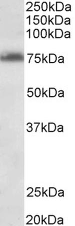 TSPYL2 Antibody in Western Blot (WB)