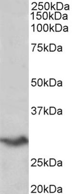 B7-H4 Polyclonal Antibody