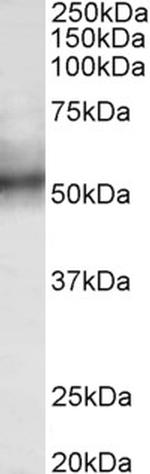 RNF92 Antibody in Western Blot (WB)