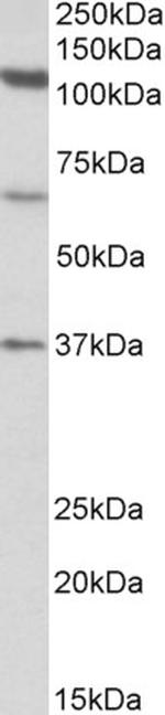 CP110 Polyclonal Antibody