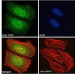 TERT Polyclonal Antibody