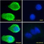 SLC6A4 Polyclonal Antibody