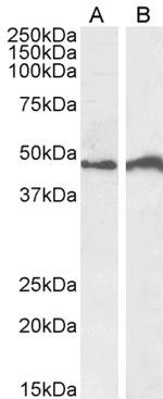 IRF4 Polyclonal Antibody
