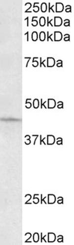 ARPC1A Antibody in Western Blot (WB)