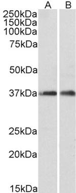 ARPC1A Antibody in Western Blot (WB)