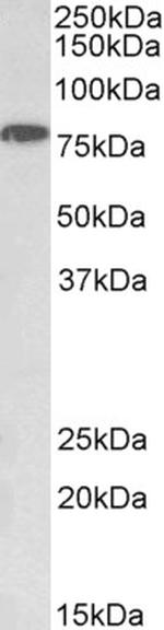 IKK alpha Polyclonal Antibody