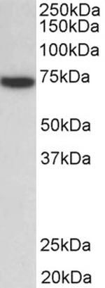 Zap-70 Antibody in Western Blot (WB)